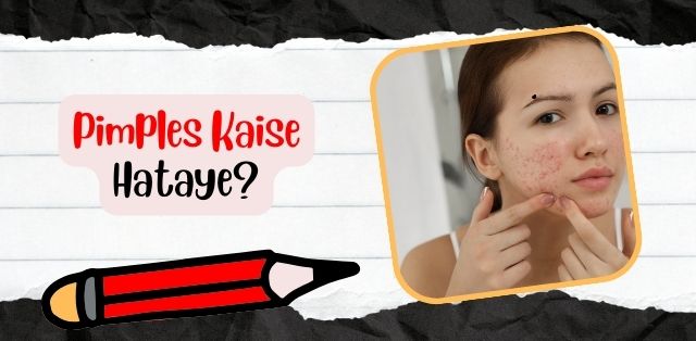 Pimples Kaise Hataye?